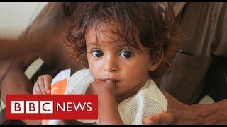 Yemen facing world’s “worst famine in decades”  BBC News [upl. by Asyral]