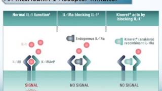 What is rheumatoid arthritis [upl. by Norahs]