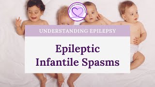 Signs of Infantile Spasms [upl. by Anelhtac623]