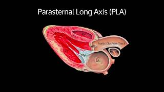 Echocardiography Essentials Detecting aortic regurgitation [upl. by Joselyn]