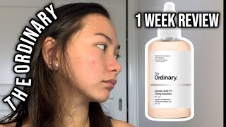 The Ordinary Glycolic Acid 7 Toning solution  1week results [upl. by Abbate]