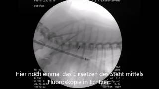 Trachealkollaps des Hundes  Diagnose amp Therapie [upl. by Ojyram526]