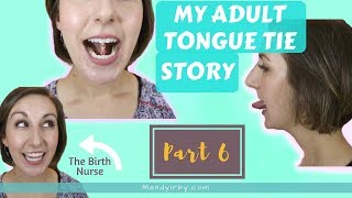 How to Stretch after ADULT TONGUE TIE Release  Part 6 [upl. by Dirfliw]