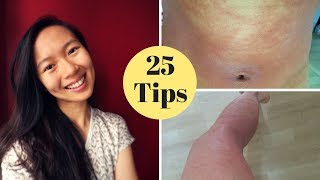 HOW I CURED MY ECZEMA [upl. by Ludwig715]