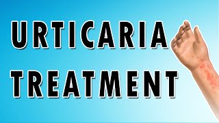 Urticaria Symptoms Treatment and Causes [upl. by Annai23]