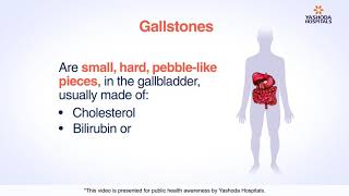 Primary Sclerosing Cholangitis Visual Explanation for Students [upl. by Gardas889]