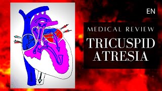 Esophageal Atresia Explained  Cincinnati Childrens [upl. by Baillie]