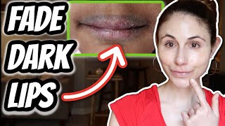 HOW TO FADE DARK LIPS  Dr Dray [upl. by Aliehs590]