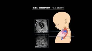 Fetal Echocardiography Protocol and Technique [upl. by Scrogan]