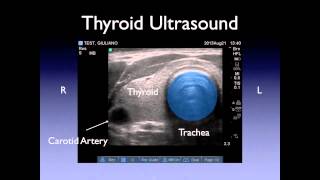 Neck Ultrasound [upl. by Dawkins]