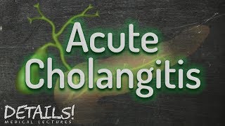 Acute Cholangitis  Tokyo Guidelines 2013  Details [upl. by Etnom]