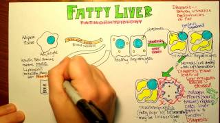 Metabolism  The Metabolic Map Lipids [upl. by Ronnica]