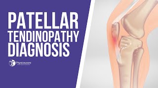 How to Diagnose Patellar Tendinopathy  Jumpers Knee Diagnosis [upl. by Freed]