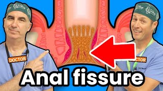 What Is An Anal Fissure [upl. by Koy]