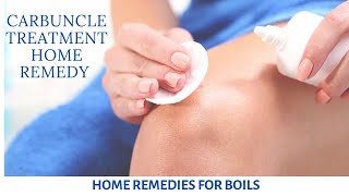 Carbuncle treatment home remedy  Home remedies for boils [upl. by Raven]