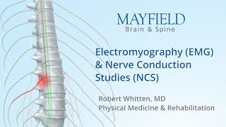 Electromyography EMG amp Nerve conduction studies NCS [upl. by Eitsirc]