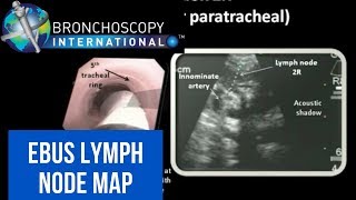 Anatomy  The Three Types of Skin Cancers [upl. by Coleman]