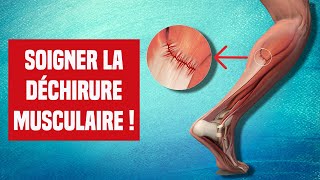 SOIGNER UNE DÉCHIRURE MUSCULAIRE  EXPLICATION ET TRAITEMENT [upl. by Eimak]