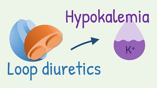 How diuretics cause hypokalemia [upl. by Mclaurin]