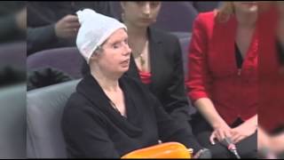 Chimp Attack Victim Speaks to CT Lawmakers [upl. by Anivla]