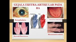 Briefing Praktikum Imunologi P4 Pemeriksaan Rheumatoid Factors [upl. by Ynogoham]