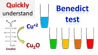 Benedicts test [upl. by Salmon]