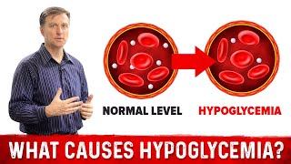 What Causes Hypoglycemia – DrBerg [upl. by Constanta]