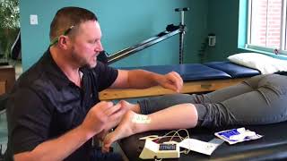 Iontophoresis in Physical Therapy [upl. by Ansilme]