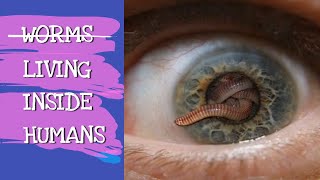 WORMS LIVING INSIDE HUMANS  EXPLAINED [upl. by Gibbons]