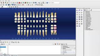 Hard Tissue Charting on Dentrix [upl. by Aliab]