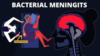 Meningitis amp Encephalitis Overview Epidemiology and Diagnostics [upl. by Okubo]