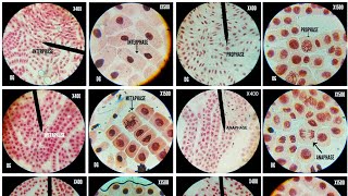 Onion root tip cell division stages at different magnificationsX400X675 amp X1500 [upl. by Ylrehs855]