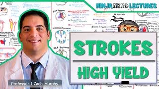 Khan Academy  The Ischemic Cascade in Stroke [upl. by Slerahc]