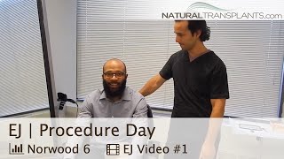 Norwood 6 Man Hair Loss  Hair Transplant Surgery Day  Dr Kevin Blumenthal EJ [upl. by Raul]