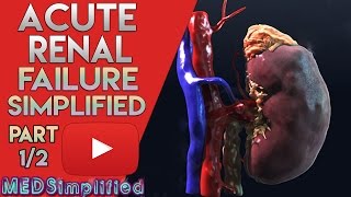 Acute kidney Failure Made Easy Part 12 [upl. by Osanna]