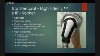 Lower Limb Prosthetics Sockets and suspensions [upl. by Schmeltzer556]