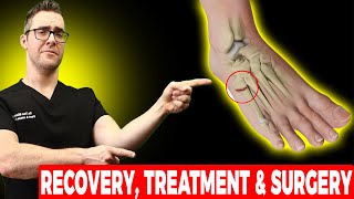 5th Metatarsal Jones Fracture Recovery Treatment amp Surgery [upl. by Boehike]