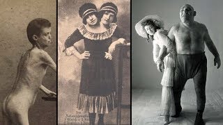 The Dark History of FREAK SHOWS [upl. by Ludly]