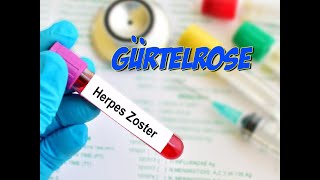 Herpes Zoster Gürtelrose  Krankheitslehre  Pflege Kanal [upl. by Male139]