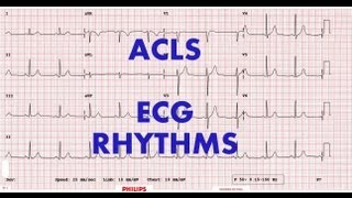 ACLS  ECG rhythm recognition amp management Part 1 [upl. by Donall955]