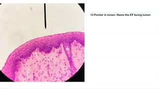 Epithelial Tissue Practice quiz [upl. by Koval]