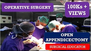 Endoscopy  Upper GI Surgery PreOp® Patient Education [upl. by Ruhtracm417]