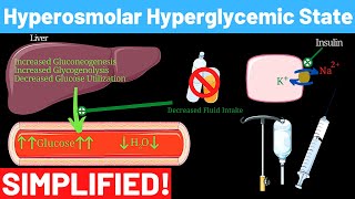 Hyperosmolar Hyperglycemic Nonketotic Syndrome  Panmedicad [upl. by Ledeen]