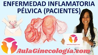 ENFERMEDAD INFLAMATORIA PÉLVICA EPI PACIENTES síntomas y tratamiento Ginecología y Obstetricia [upl. by Eckhardt70]