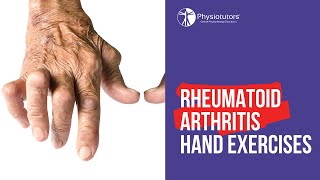 HOW I CURED MY RHEUMATOID ARTHRITIS [upl. by Accem]