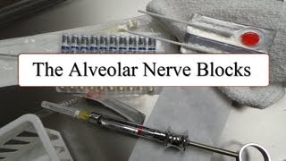 Popliteal Nerve Block How To [upl. by Whitehurst]