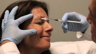 Crows Feet botulinum toxin injection training [upl. by Itsirc]