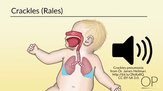 Respiratory Assessment by B Leary L DelSignore  OPENPediatrics [upl. by Elana155]