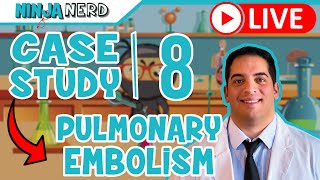 Case Study 8 Pulmonary Embolism [upl. by Nahgam]