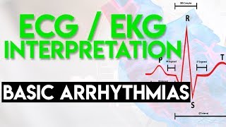 Basic Arrhythmias  Sinus Brady Tachy Premature Beats  ECG EKG Interpretation Part 3 [upl. by Belford187]